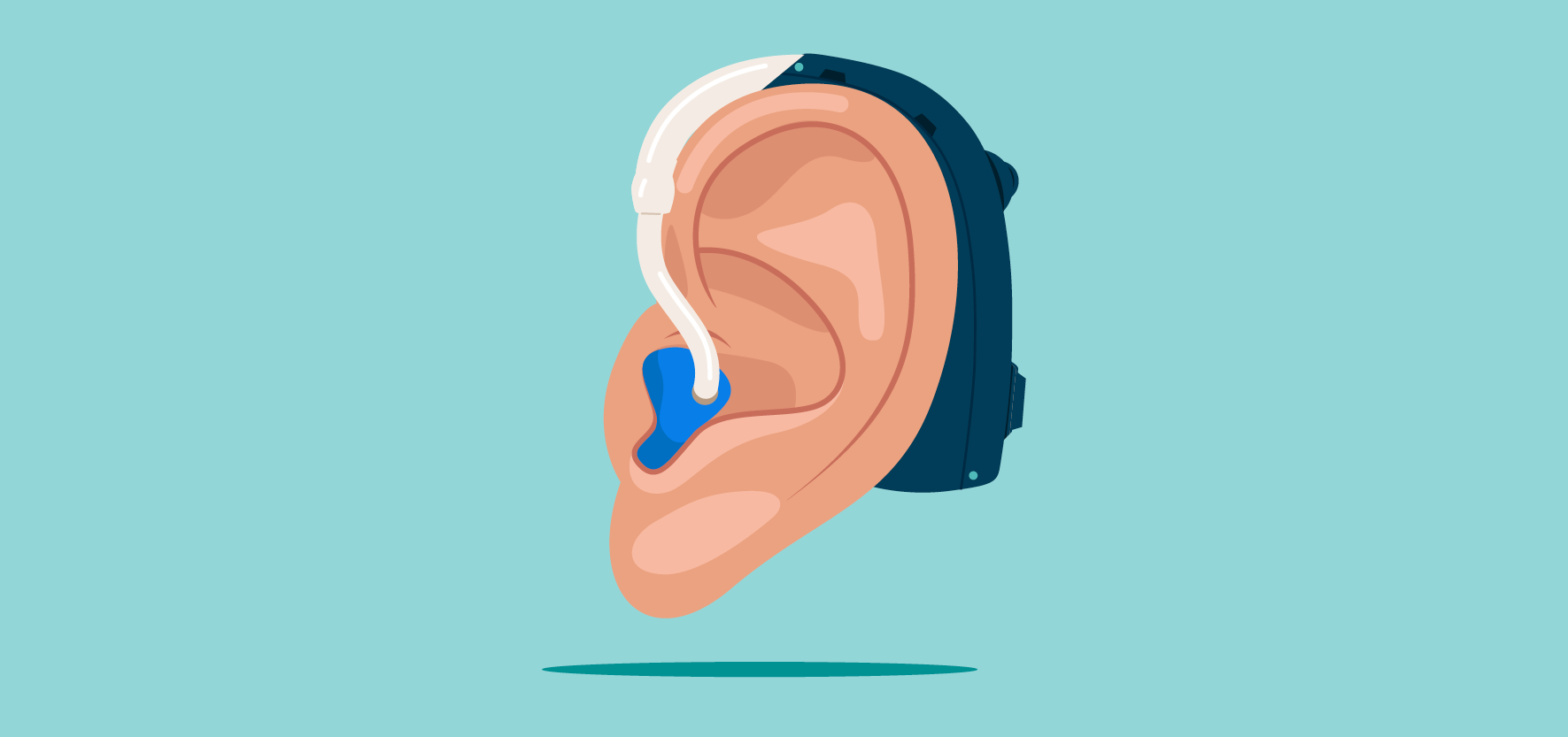 An illustration of an ear wearing a hearing aid